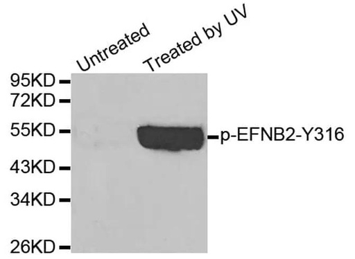 Antibodie to-EFNB2 (phospho Y330) 