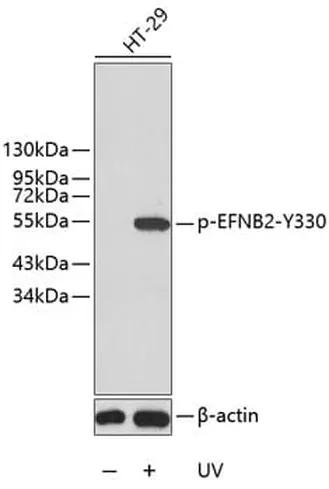 Antibodie to-ESR1 (phospho S106)  - Identical to Abcam (ab194784) and Novus (NB100-81912)