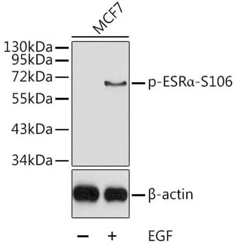 Antibodie to-ESR1 (phospho S167)  - Identical to Abcam (ab131105)