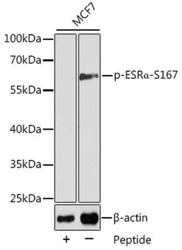 Antibodie to-EZR (phospho Y353) 