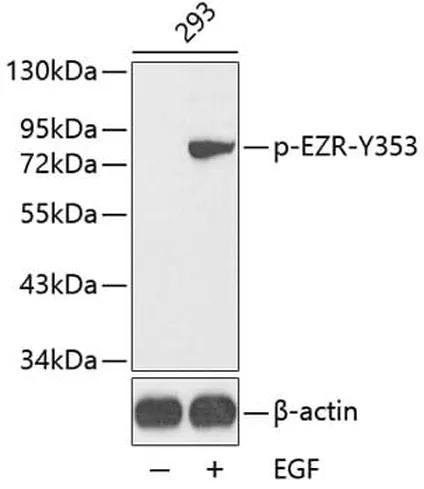 Antibodie to-ITGB3 (phospho Y773) 