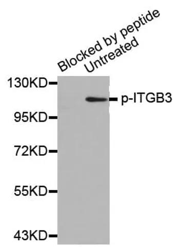 Antibodie to-TYK2 (phospho Y1054) 