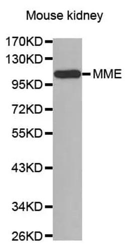 Antibodie to-PRKD1 