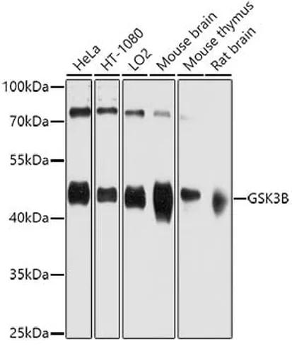 Antibodie to-GSK3B  [Assigned #A0480]