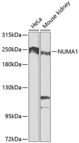Antibodie to-PKM  [Assigned #A0540]