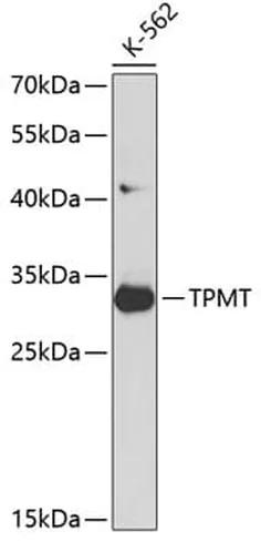 Antibodie to-PDX1 