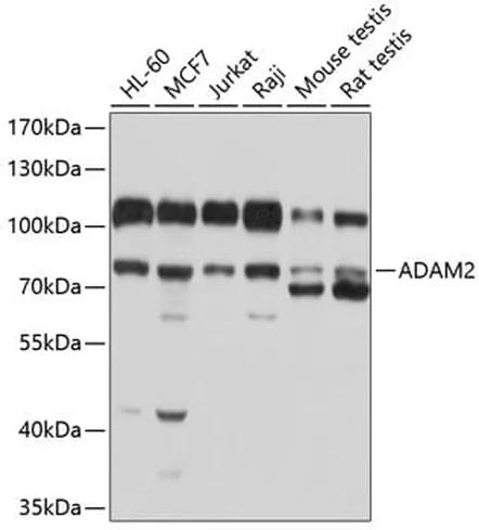 Antibodie to-ADA  - Identical to Abcam (ab175310)