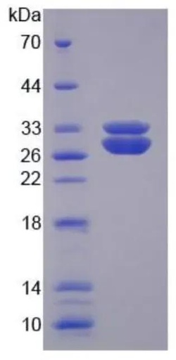 Human AHA-1 protein (active)