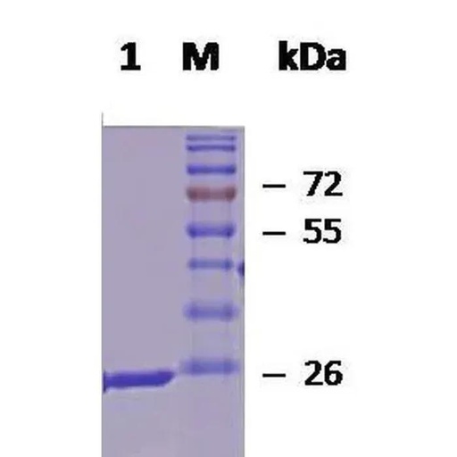 Human HSP60 protein (active)